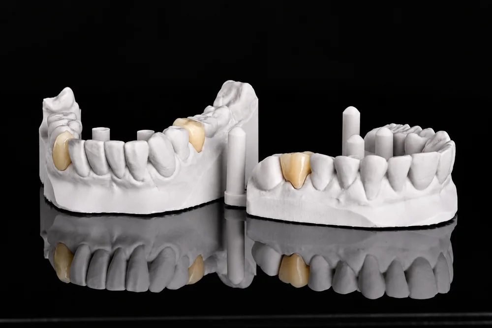 Crowns on Models · Overview