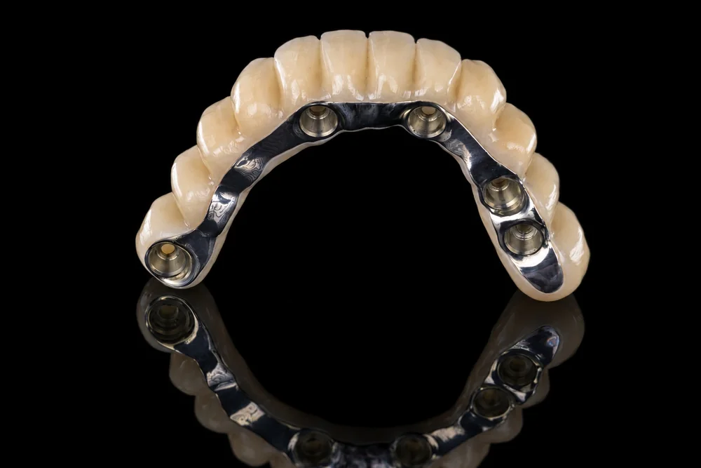Implant Restoration · Connections