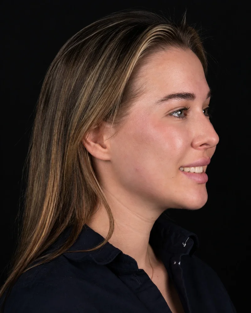 Right Profile · Smile